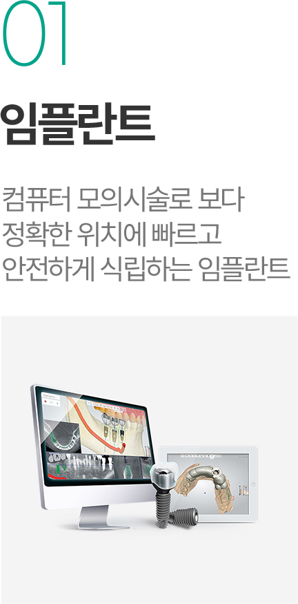 임플란트 - 컴퓨터 모의시술로 정확한 위치에 빠르고 안전하게 식립하는 임플란트