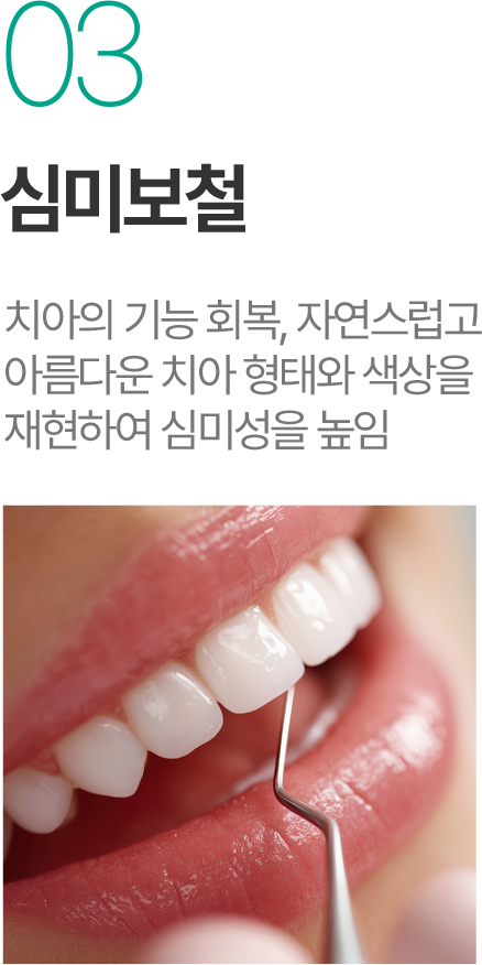 심미보철 - 자연스러운 치아 형태와 색상 재현