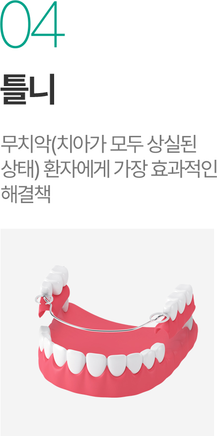 틀니 - 무치악 환자를 위한 효율적인 해결책