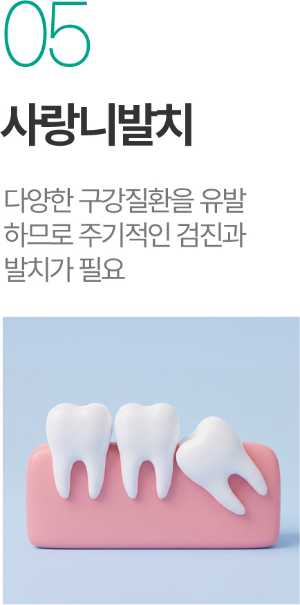 사랑니발치 - 구강질환 예방을 위한 검진과 발치