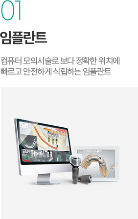임플란트 - 컴퓨터 모의시술로 정확한 위치에 빠르고 안전하게 식립하는 임플란트