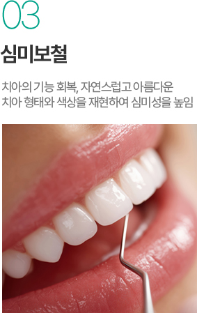 심미보철 - 자연스러운 치아 형태와 색상 재현