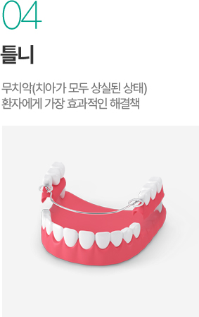 틀니 - 무치악 환자를 위한 효율적인 해결책
