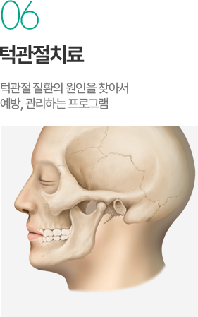 턱관절치료 - 턱관절 질환 원인 진단과 예방 관리